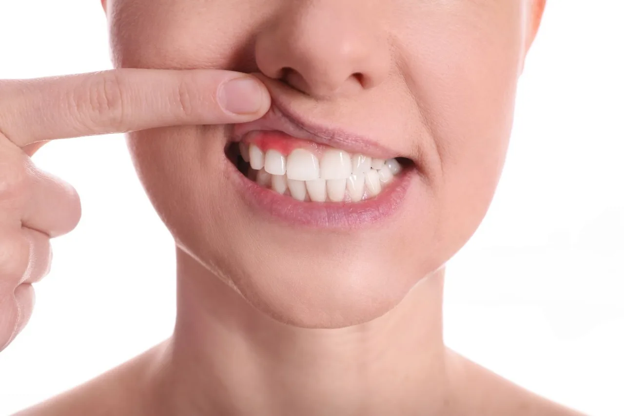 gum disease treatment