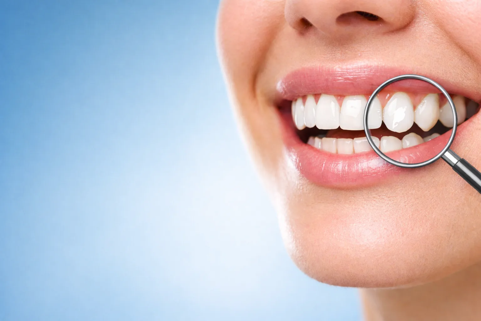 WHITE SPOTS ON TEETH